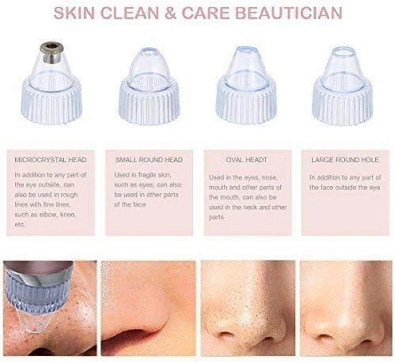 UltraGlow Pore Vacuum–وتنظيف المسام بعمق